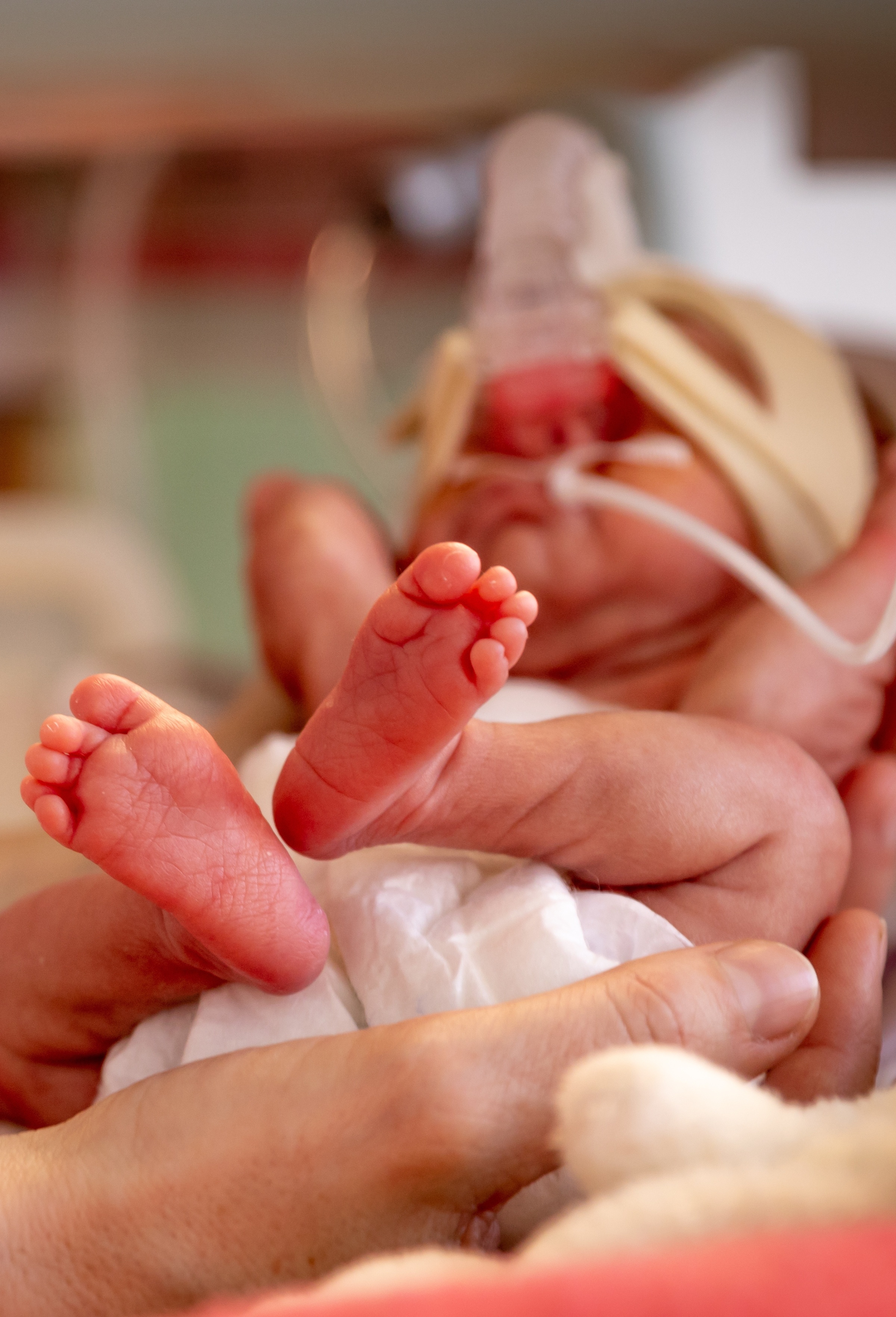 Microsite photo NICU baby (2400 x 3529 px)